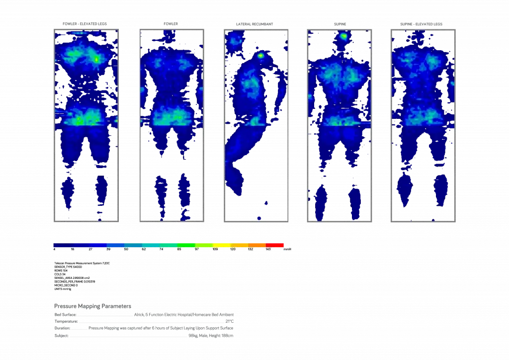 Safe-Surround-Mattress-Pressure-Mapping