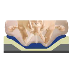 Pelvic Loading Area Determined by Common Skeletal Measurements