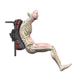 Spex-SuperShape-Render-Kyphosis-1